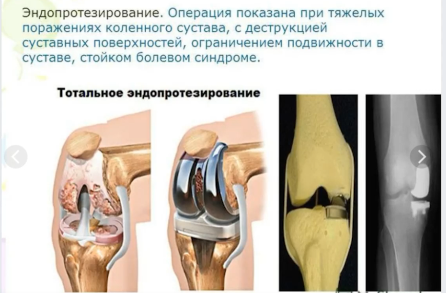Расписание болезней - поменялось постановление 565 о ВВК voenset.ru 