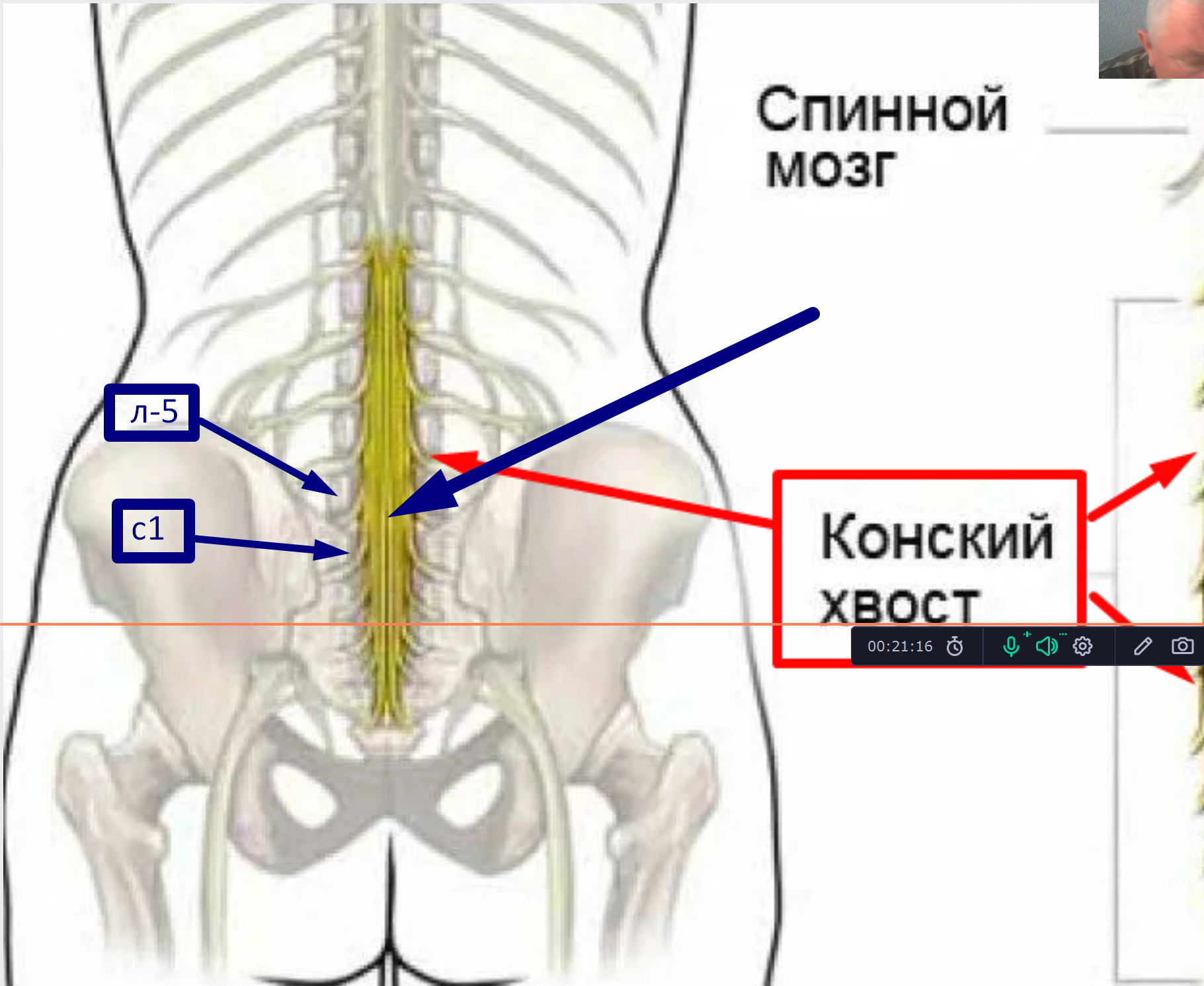 ВВК спина  категория В  выводы на первой части консультации voenset.ru