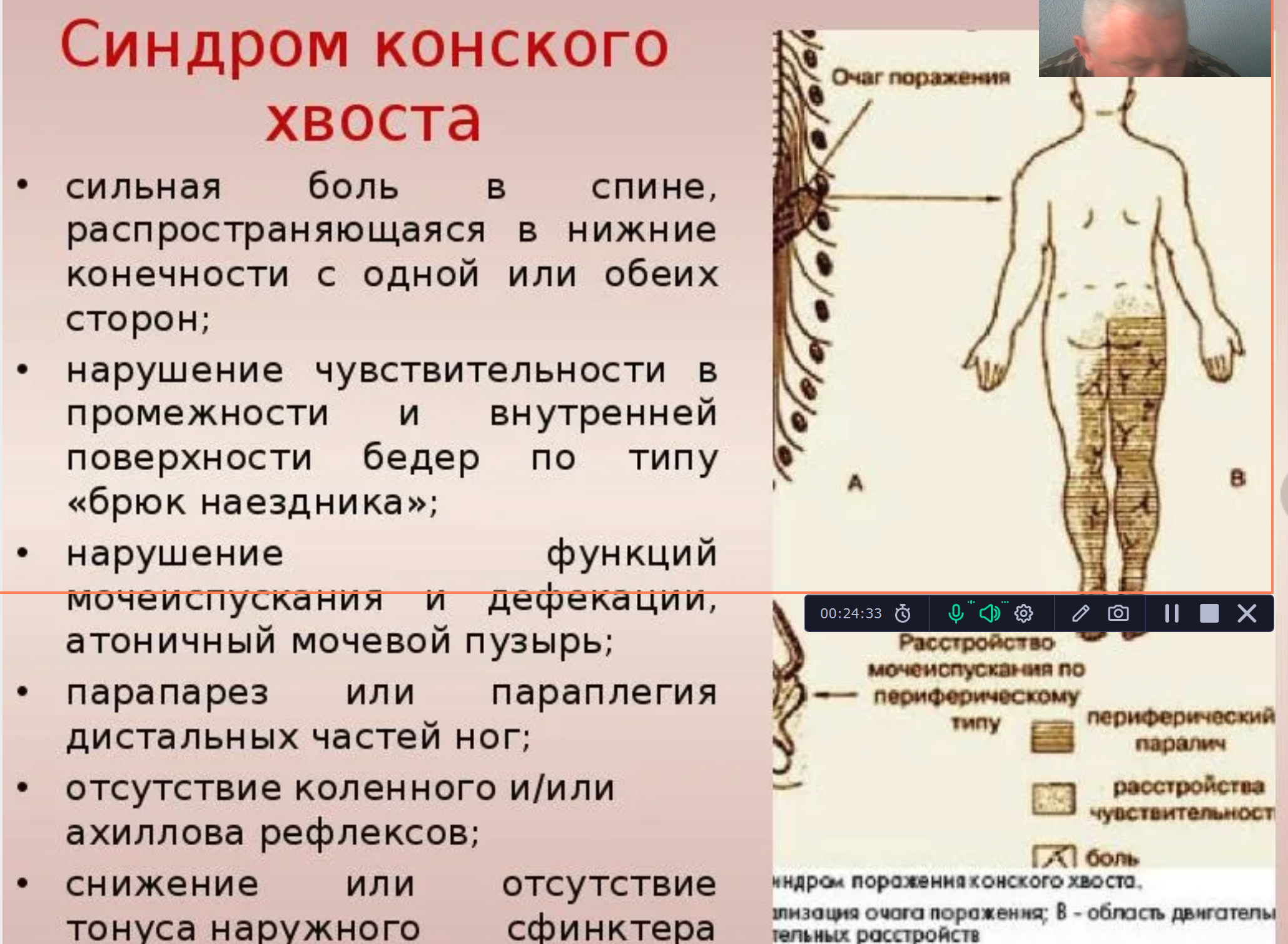 Спина увольнение , потом семейцные - не выходит никак 