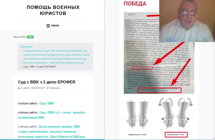 Плоскостопие   получили категорию Д очередной процесс закончен победой