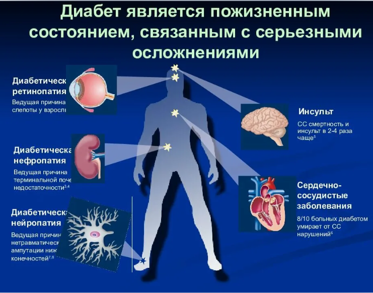 Сахарный диабет - СВО  - ВВК - увольнение  voenset.ru   1