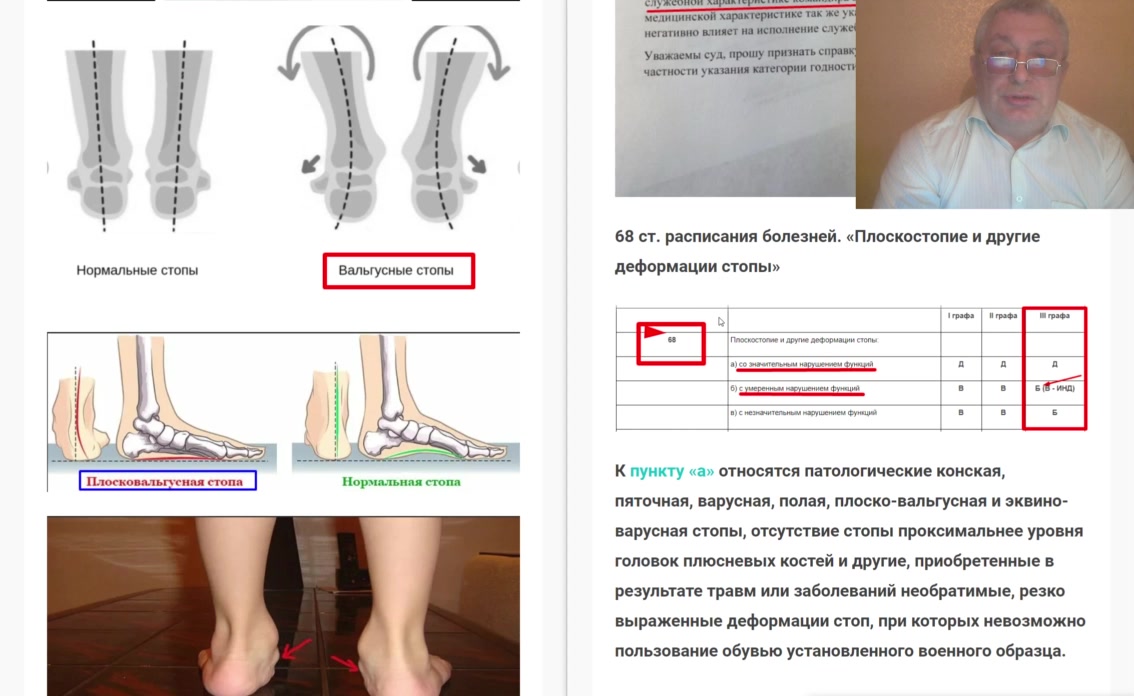 Плоскостопие - подготовка к суду 